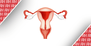 Оцінка прохідності маткових труб та її вплив на кровотік і функцію яєчників: порівняння гістеросальпінгографії та гістеросальпінго-контрастної сонографії - Новини RH