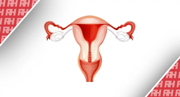 Оцінка прохідності маткових труб та її вплив на кровотік і функцію яєчників: порівняння гістеросальпінгографії та гістеросальпінго-контрастної сонографії - Статті RH