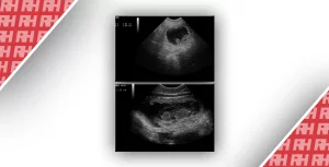 Ультрасонография для оценки беременности у самок собак - Новини RH