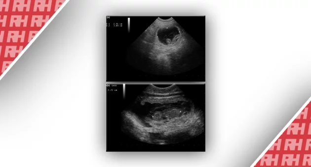 Ультрасонографія для оцінки вагітності у самок собак - Статті RH