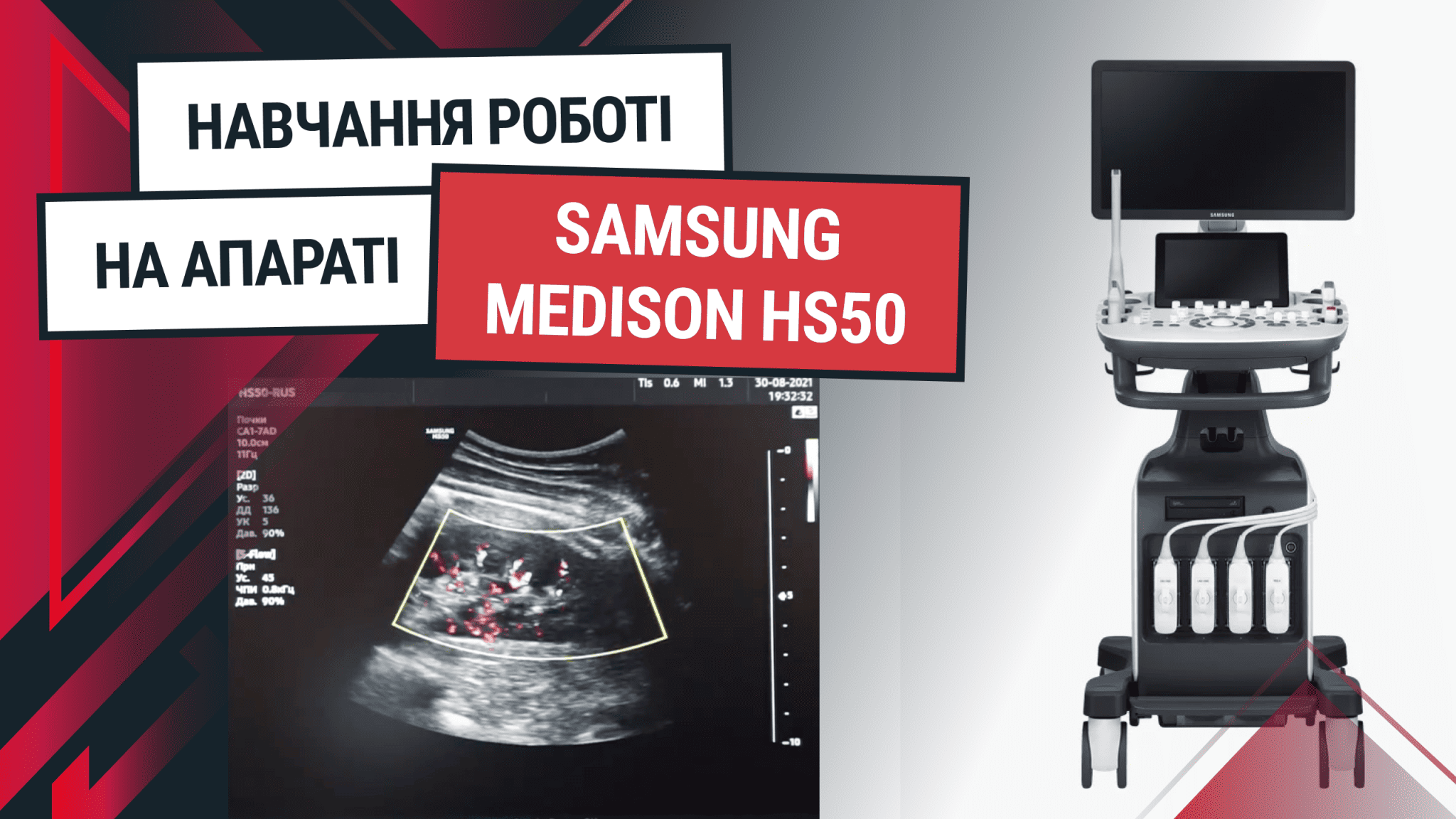 Навчання роботі за УЗД апаратом SAMSUNG HS50 на конвексному, лінійному, кардіологічному датчиках - Статті RH